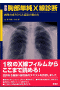 楽天ブックス 新版胸部単純x線診断 画像の成り立ちと読影の進め方 林邦昭 本 楽天ブックス 新版胸部単純x線診断 画像の成り立ちと読影の進め方 林邦昭 本